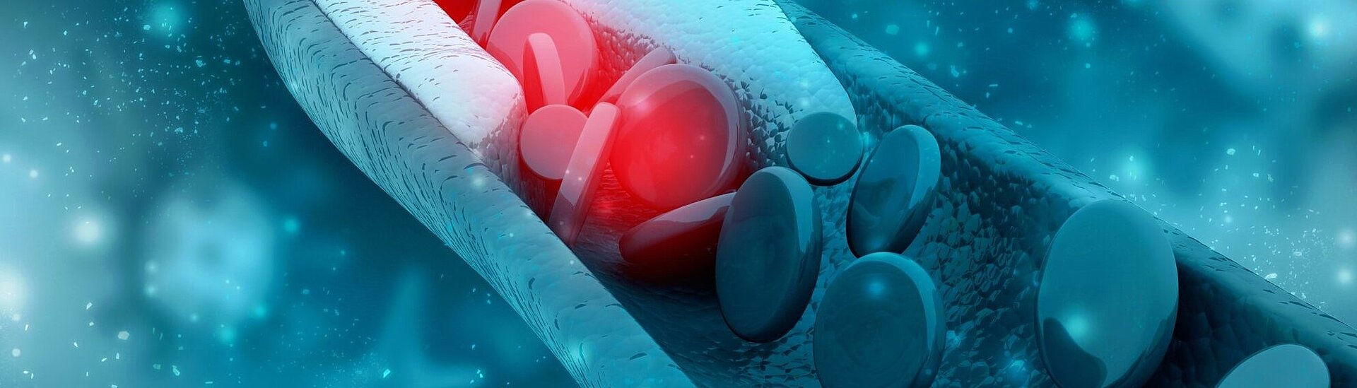 PI Ceramic - Cardiovascular Surgery