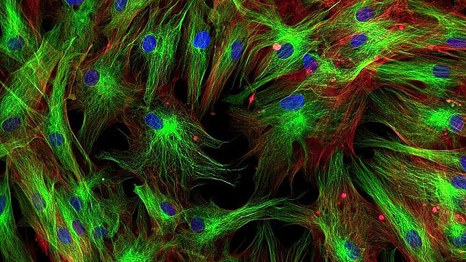 全内部反射蛍光顕微鏡(TIRFM)のポジショニングソリューション